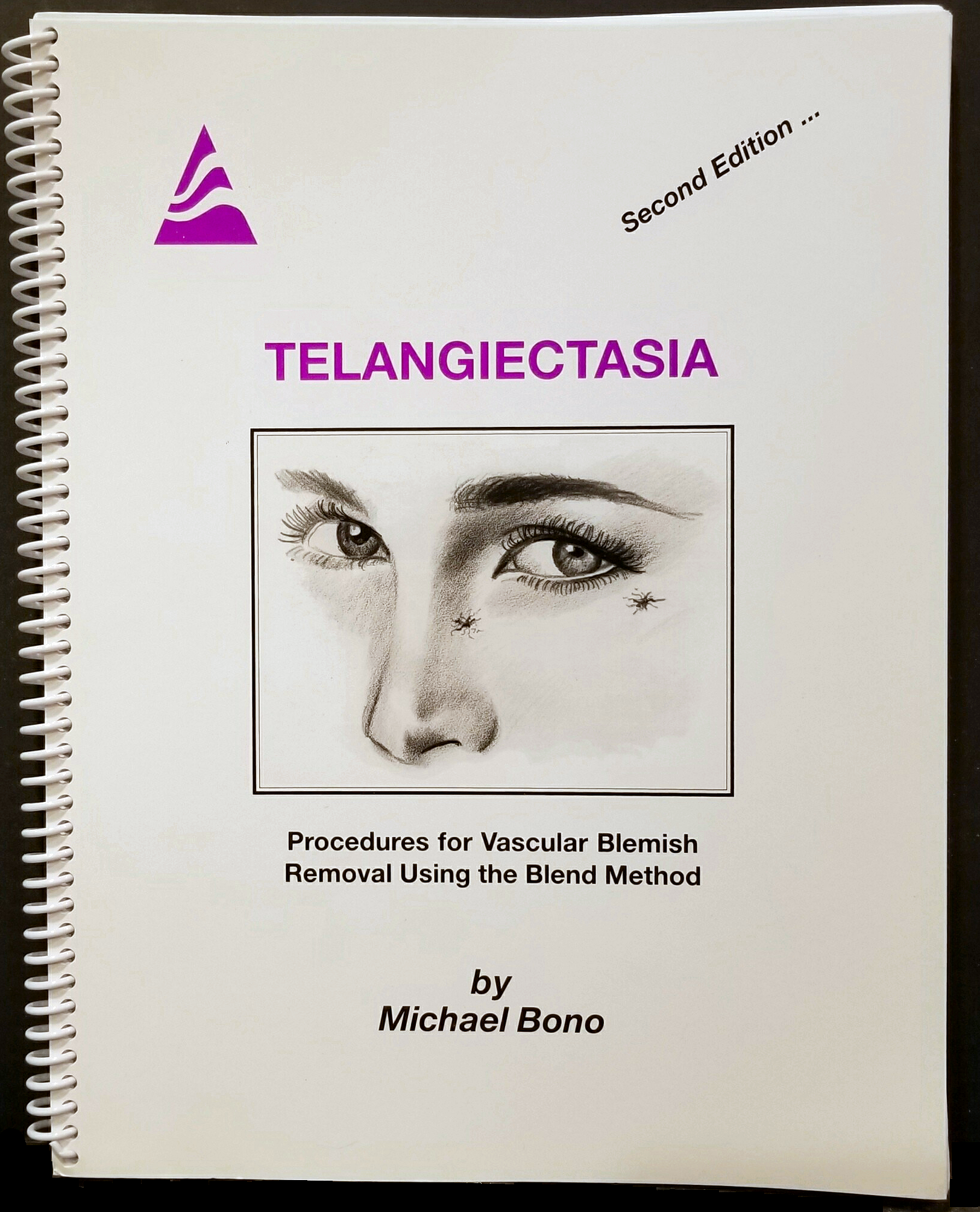 Telangiectasia - 2nd Edition - Click Image to Close